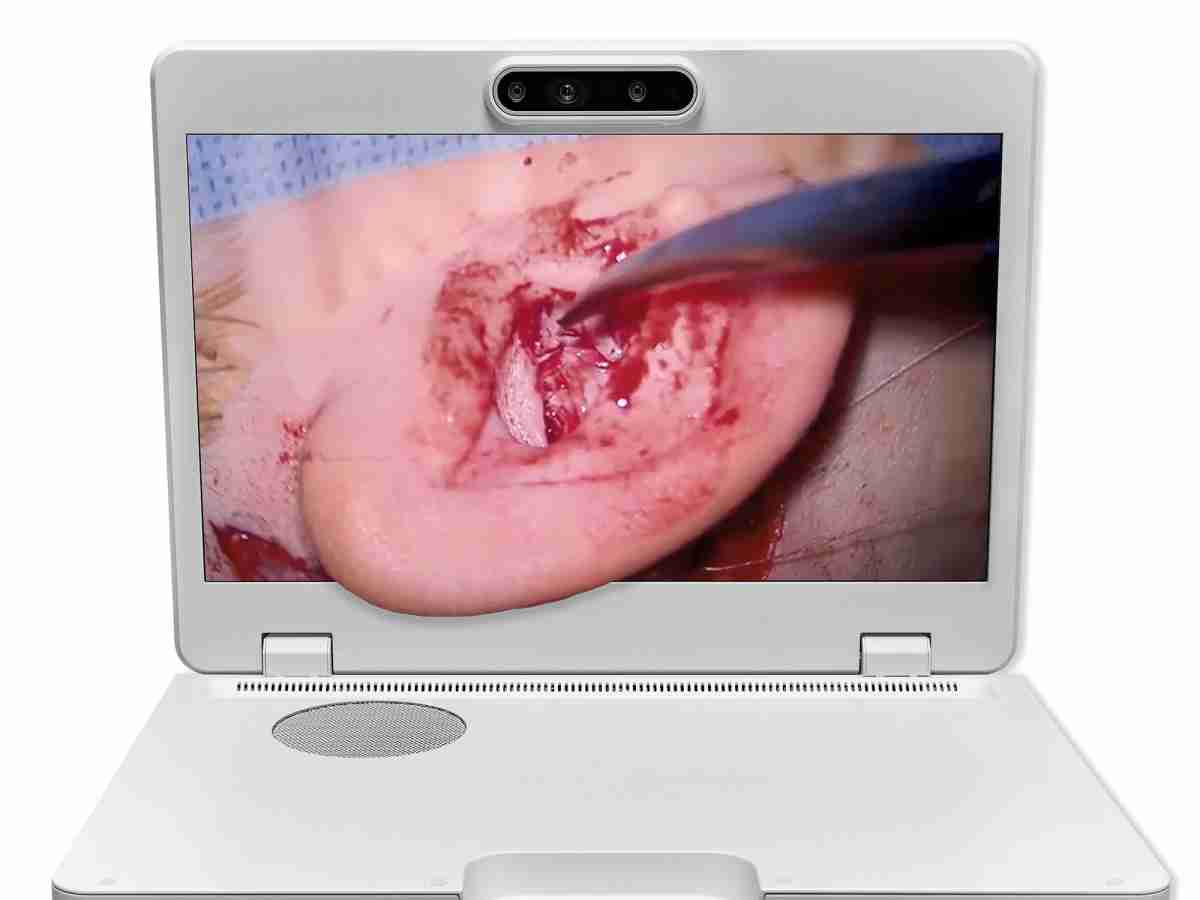 达擎之＂Heads-up 3D显微手术显示系统＂，，，整合4K裸眼3D显示及眼球追踪系统，，，，具备快速追踪人眼移动位置功能，，，，减轻医师长时间维持固定姿势的负担，，，让医师能有更宽广清晰的3D立体视野及更舒适的姿势来执行手术。。。。